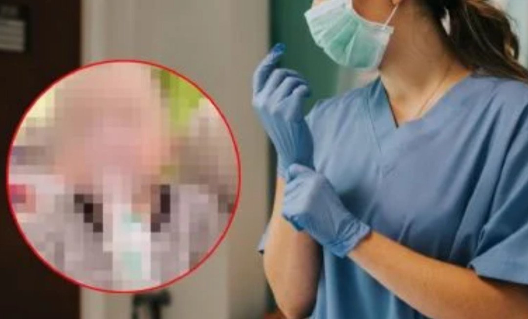 Enfermera corta el dedo a un bebé al retirarle un vendaje con tijeras en un hospital Enfermera corta el dedo a un bebé al retirarle un vendaje con tijeras en un hospital